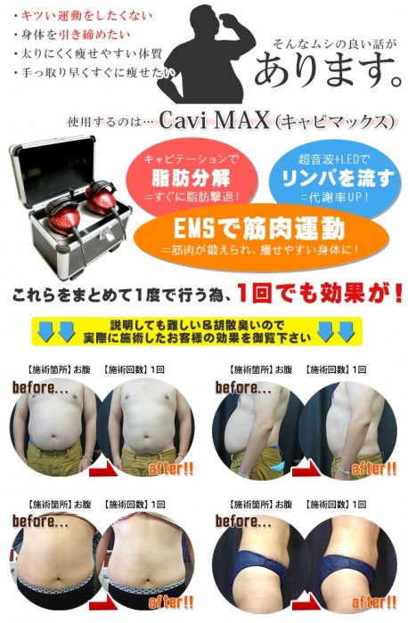 キャビマックス　キャビMAX